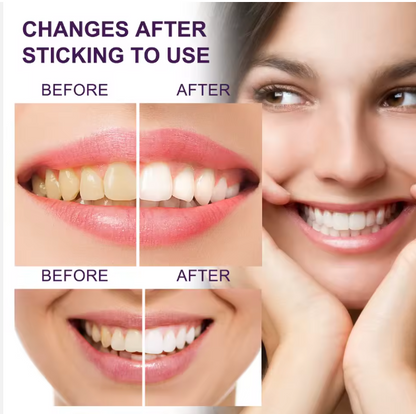 ودّع اصفرار الأسنان وامنح ابتسامتك مظهرًا أنقى في دقائق