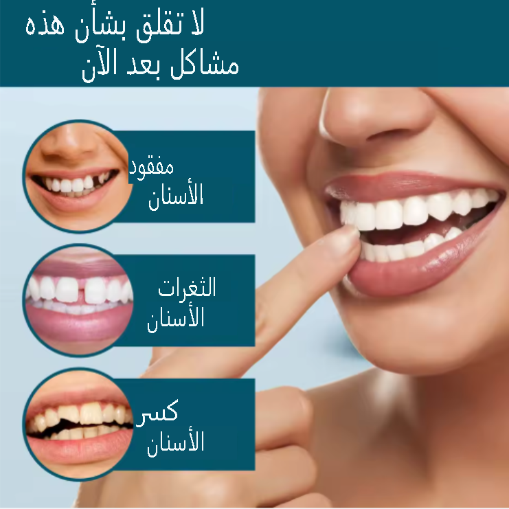 أسنان تجميلية قابلة للتركيب فوراً