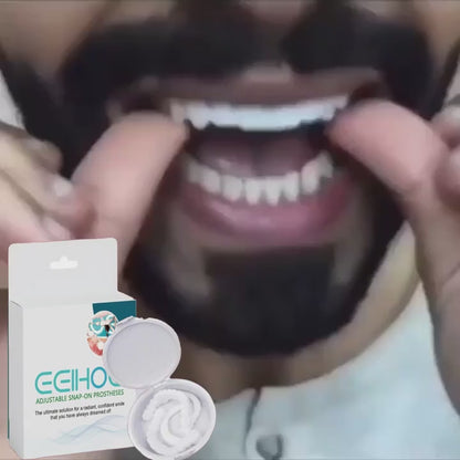 أسنان تجميلية قابلة للتركيب فوراً